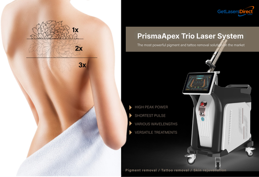 Wedding Season and Summer: The Tattoo Removal Rush You Should Already Be Booking
