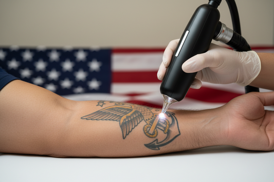 The Veterans & Military Tattoo Removal Market: Why It's the Highest-Intent Niche Most Shops Are Ignoring