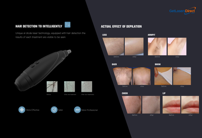 Sistema de depilação a laser de diodo Luminary Labs NovaPulse